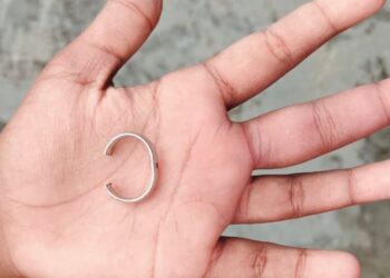 SOCORRO INUSITADO – Bombeiros são acionados para retirar anel preso no dedo