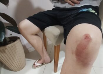 VÍDEO| Adolescente é violentamente agredido em ruas de Carmo durante a madrugada, família pede justiça