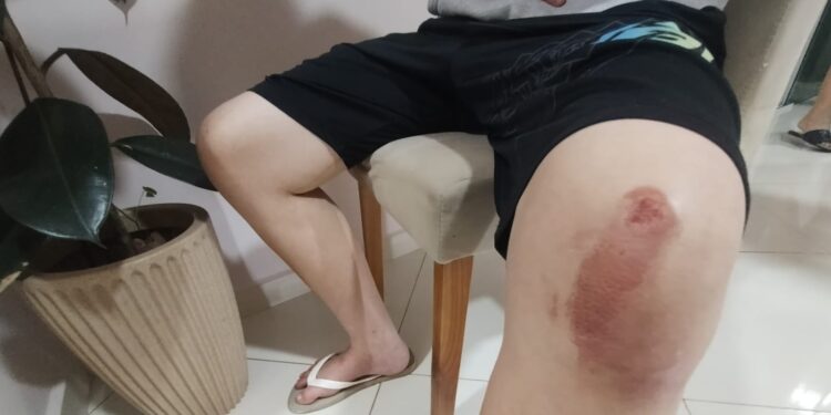 VÍDEO| Adolescente é violentamente agredido em ruas de Carmo durante a madrugada, família pede justiça