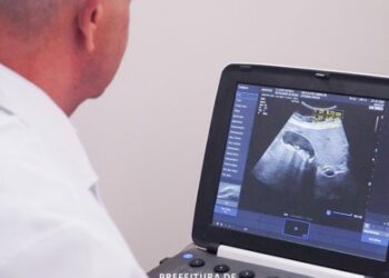 Prefeitura de Carmo realiza mutirão de ultrassonografia no ESF Continental