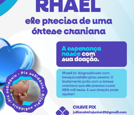 Campanha arrecada fundos para tratamento craniano infantil em Carmo