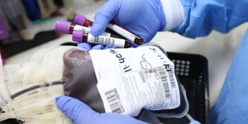 Hospital Universitário Alzira Velano de Alfenas enfrenta falta crítica de sangue O+ e faz apelo à população