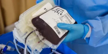 Jovem com tumor cerebral precisa de doações urgentes de sangue para nova cirurgia em Alfenas