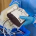 Jovem com tumor cerebral precisa de doações urgentes de sangue para nova cirurgia em Alfenas