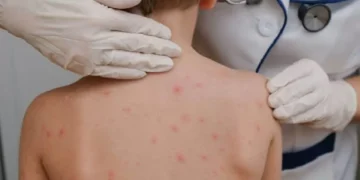 Desfile de 7 de Setembro é suspenso em Alfenas como medida preventiva contra escabiose