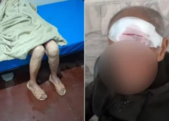 Polícia Civil investiga denúncias de maus-tratos e negligência contra idosos em instituição no Sul de Minas